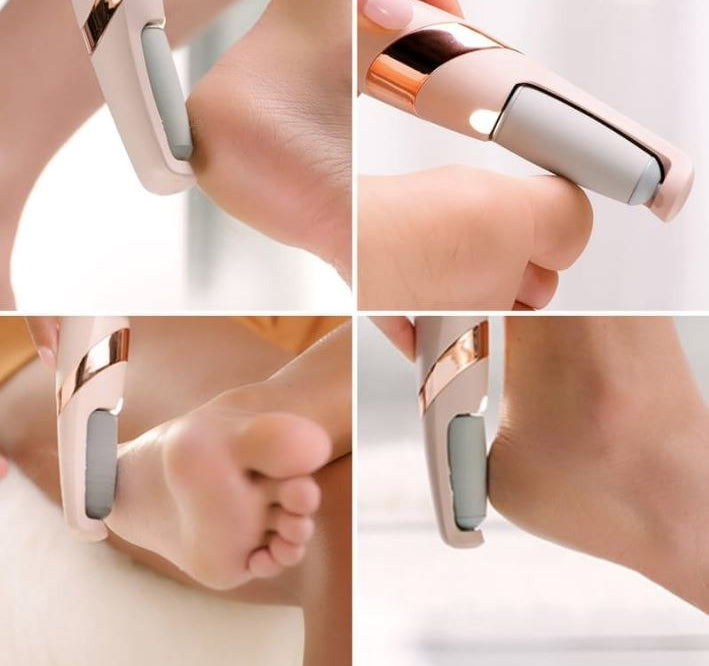 Foot Callus Remover Roller – Dead Skin & Hard Skin Exfoliating Tool